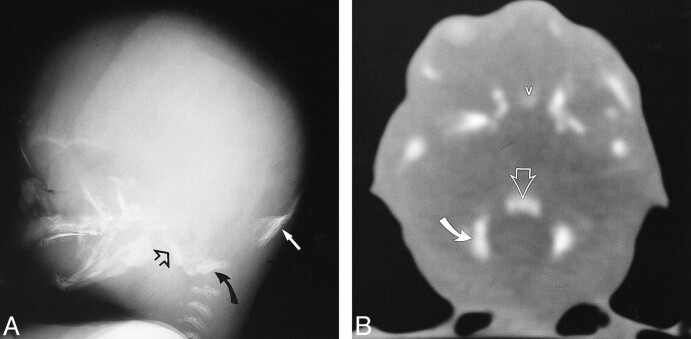 fig 14.