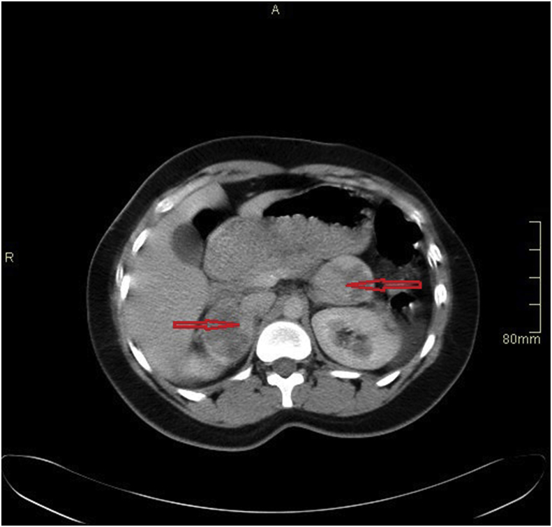 Fig. 2