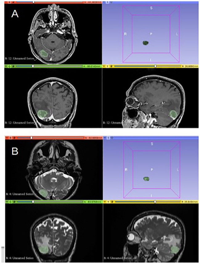 Figure 1