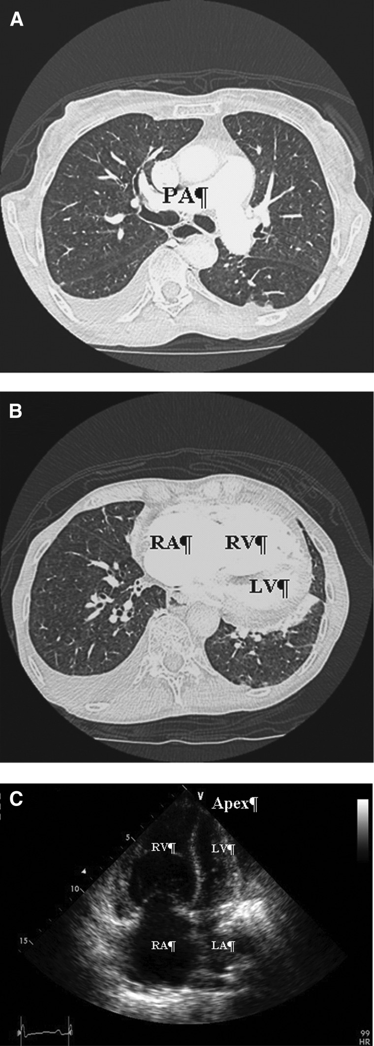 FIG. 1.