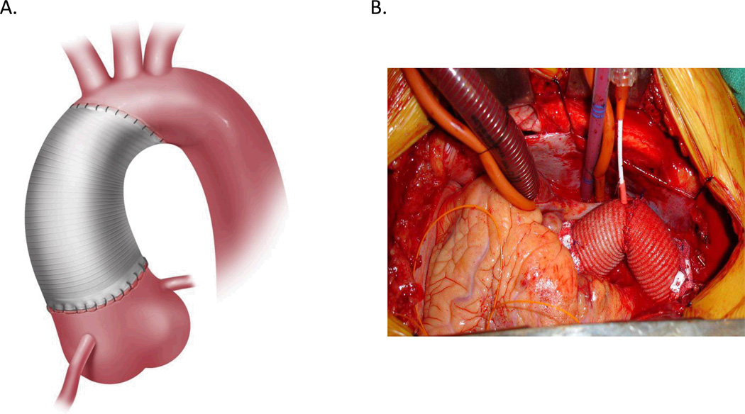 Figure1