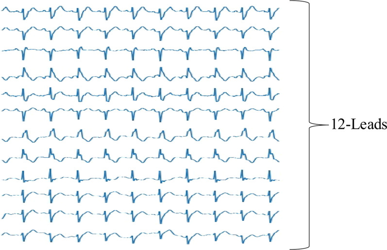 Fig. 1