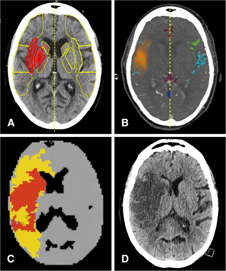 Fig. 3