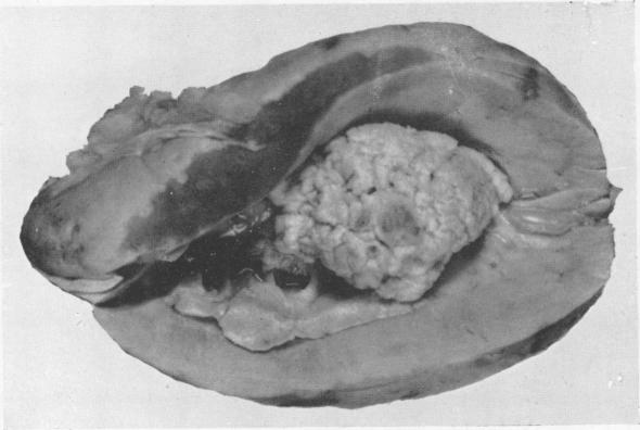 graphic file with name brjindmed00250-0019-a.jpg