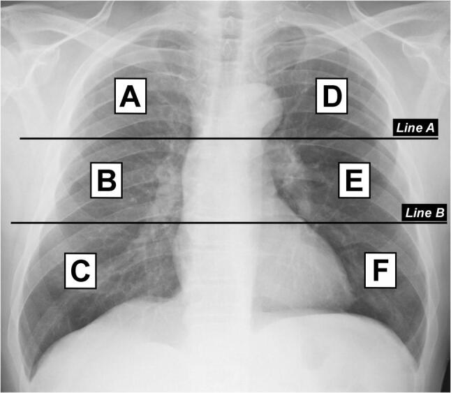 Fig. 1