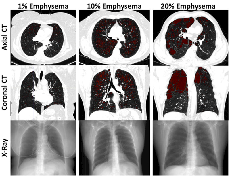 Fig 1.