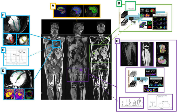 FIGURE 3