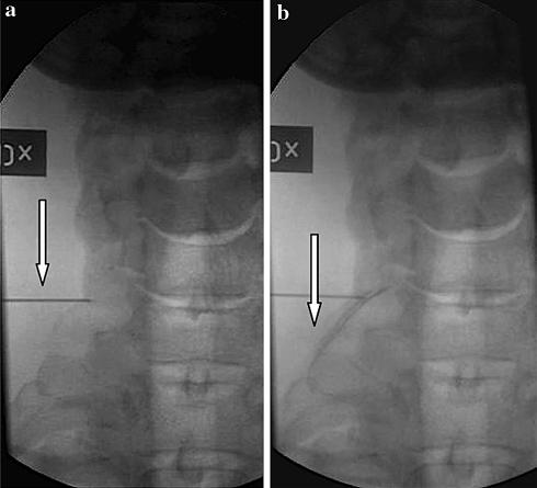 Fig. 1