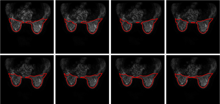 Fig. 12