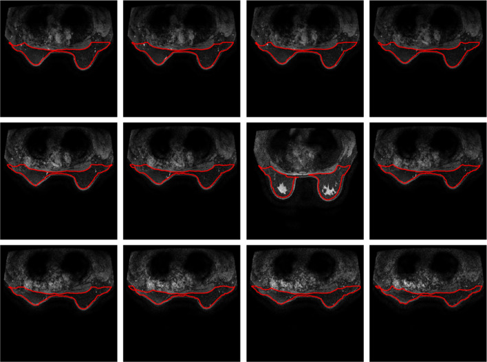 Fig. 19