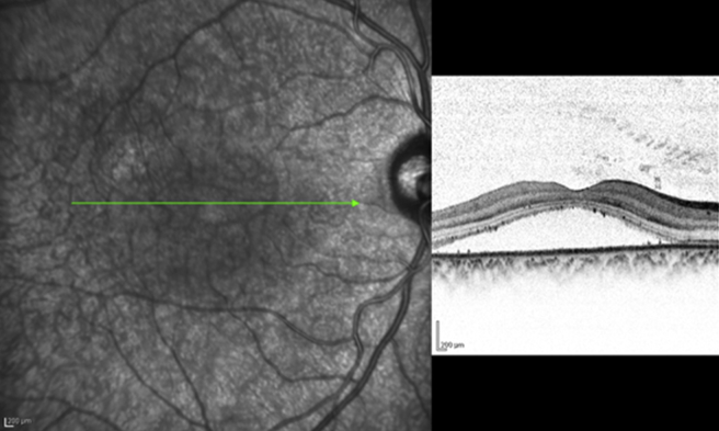 Fig. 8