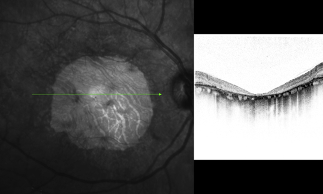 Fig. 12