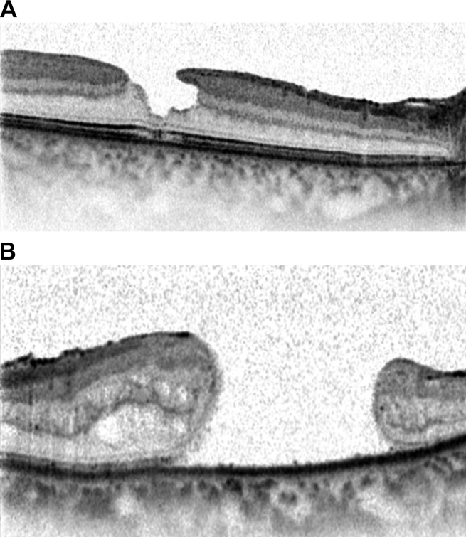 Fig. 10