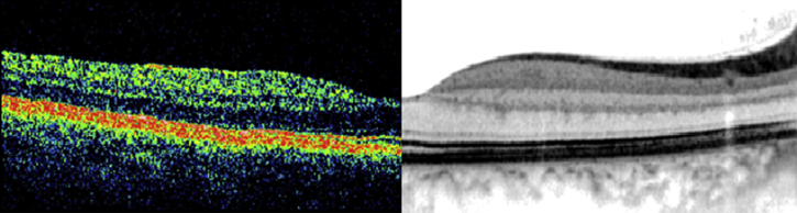 Fig. 1