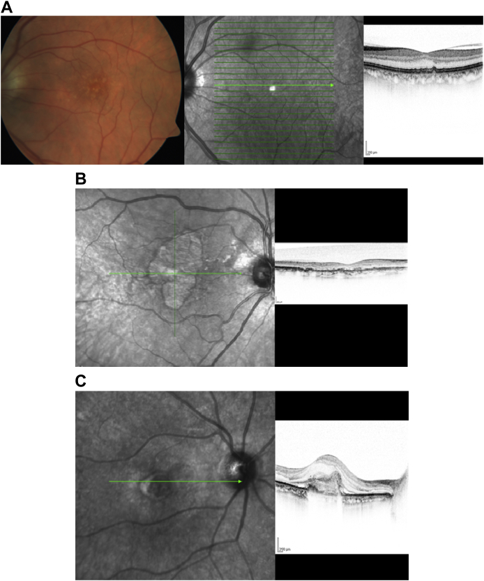 Fig. 6