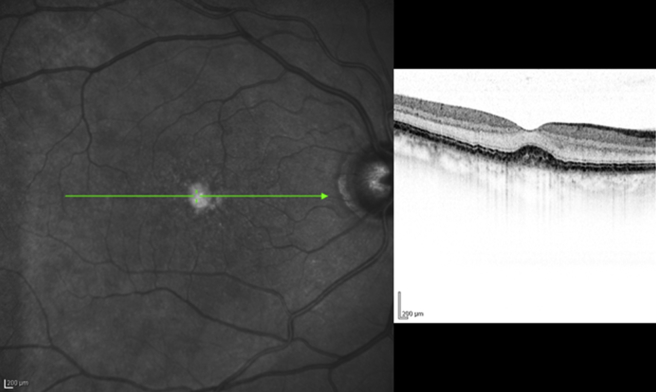 Fig. 14