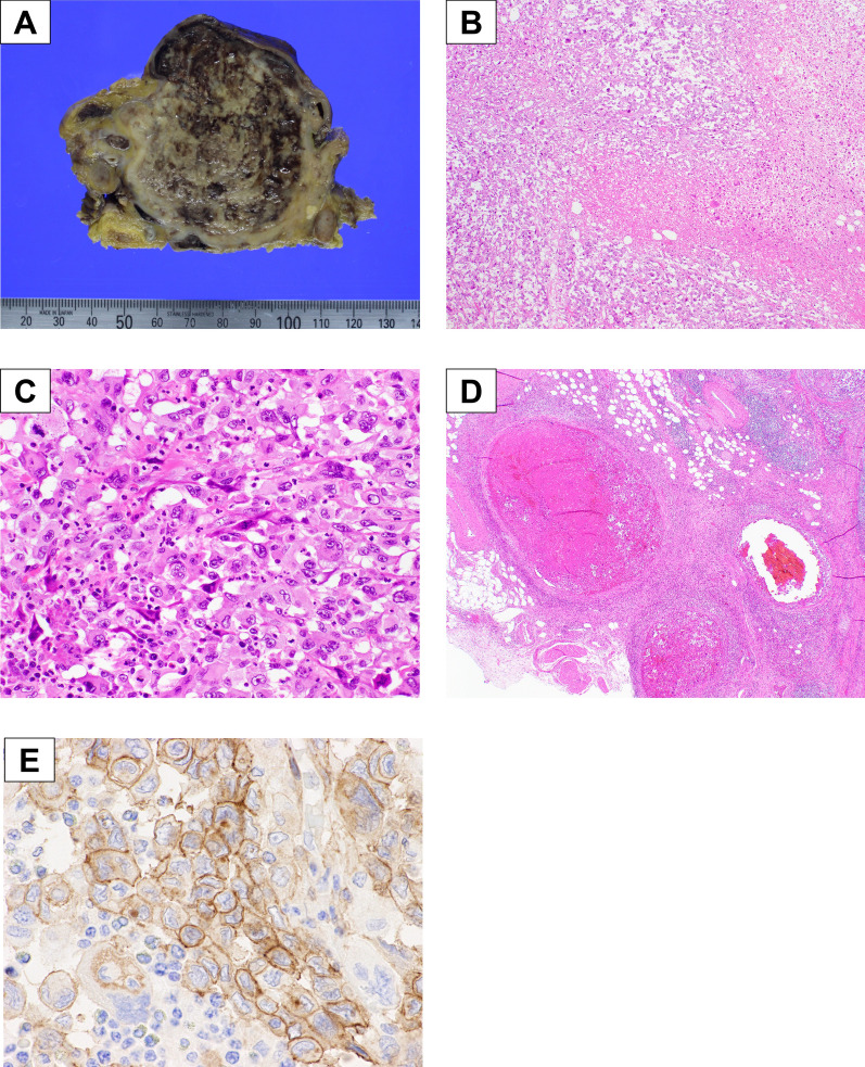 Fig. 2