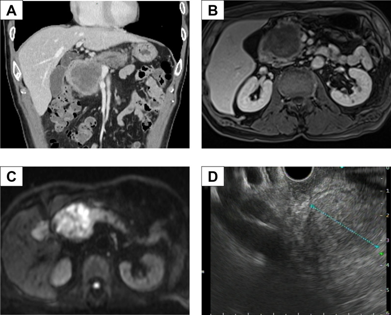 Fig. 1