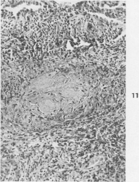 Fig. 11