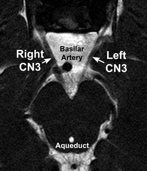 Figure 10.