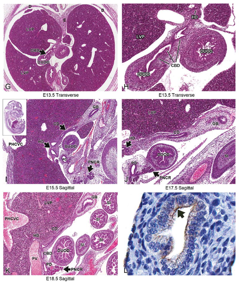 FIGURE 13