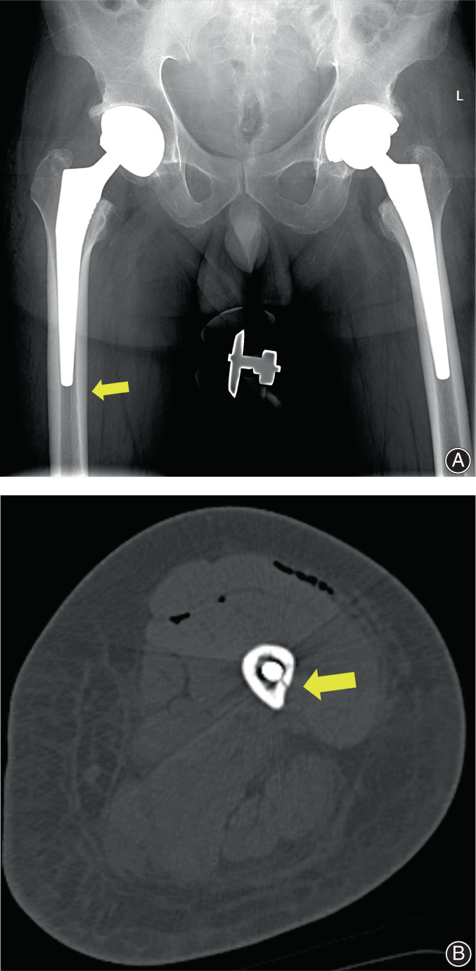 FIGURE 4