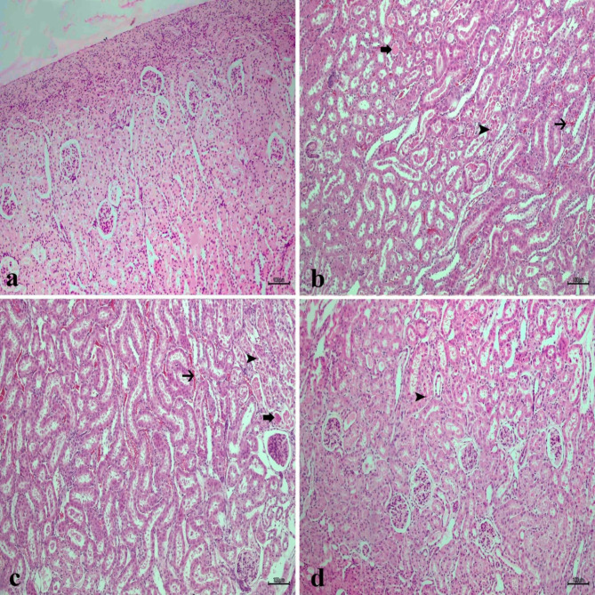 Fig. 12