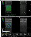 Fig. 1