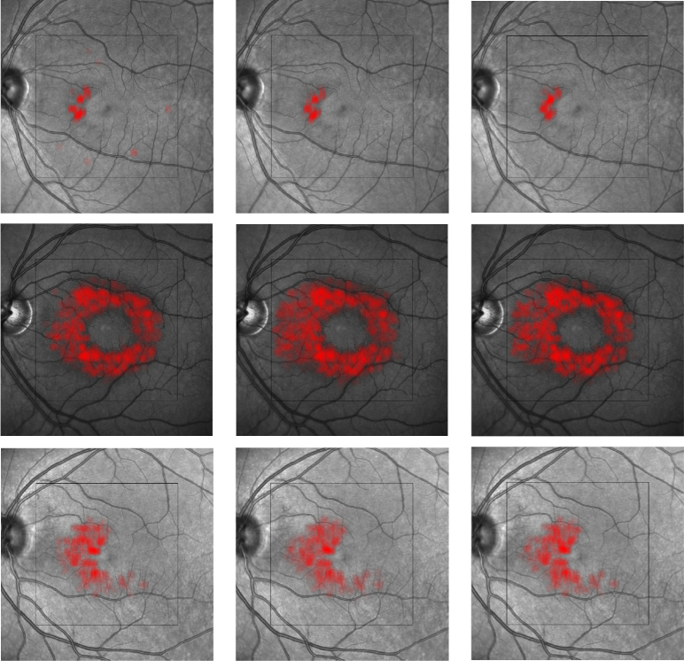 Fig. 11.