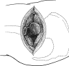 Fig. 2
