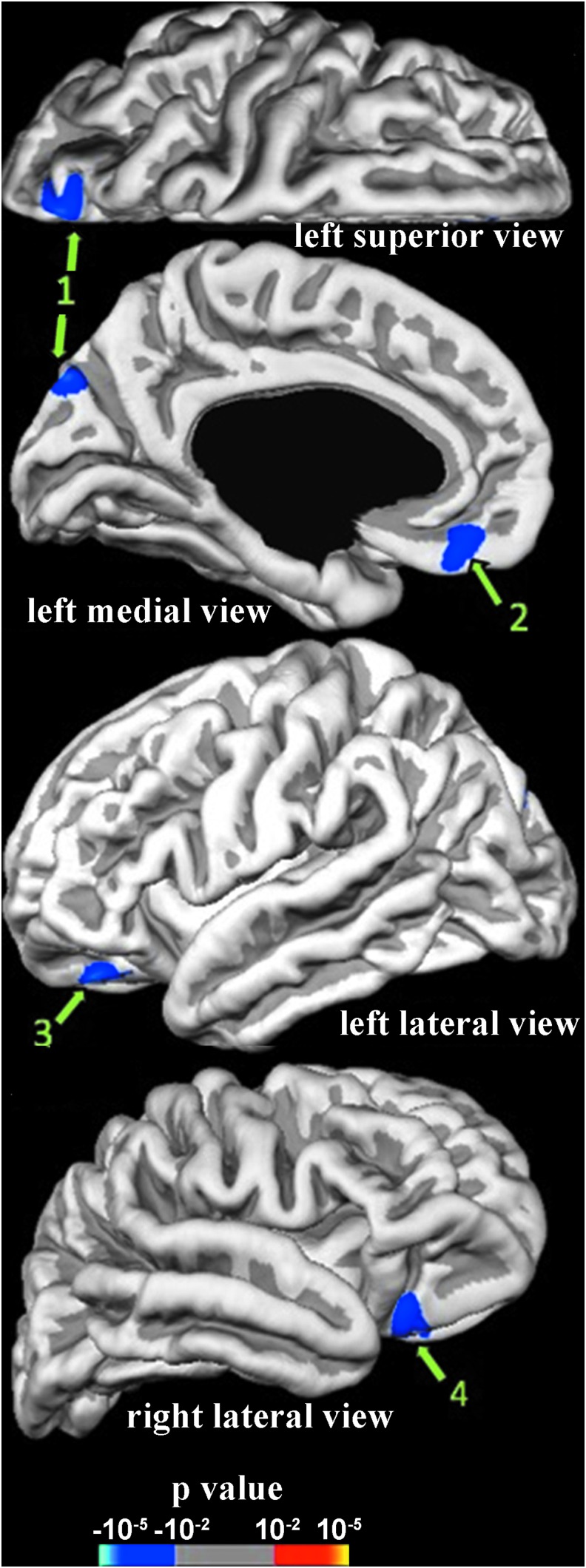 FIG. 2.