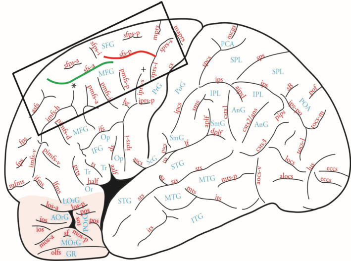 FIGURE 1