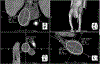 FIG. 2.