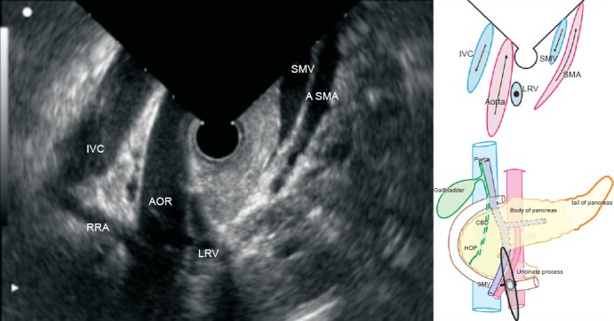 Figure 18