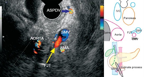 Figure 19