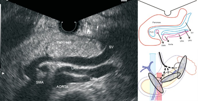 Figure 14