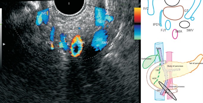 Figure 21