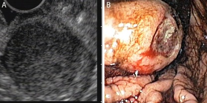 Fig. 5