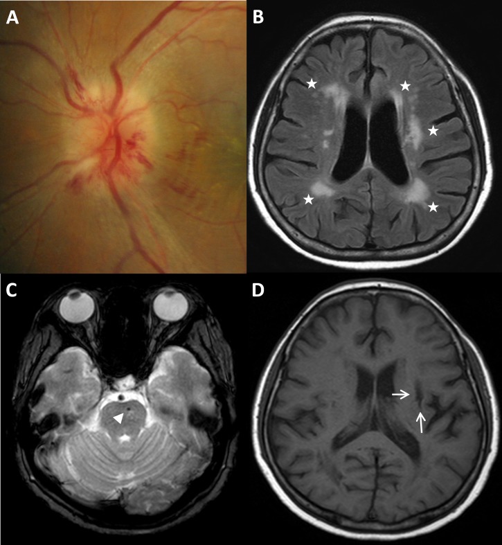 Fig 2