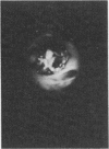 281