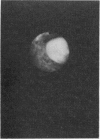 281