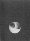 281