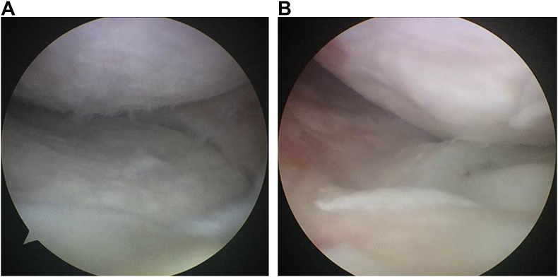 Fig. 5