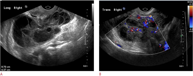 Fig. 12.