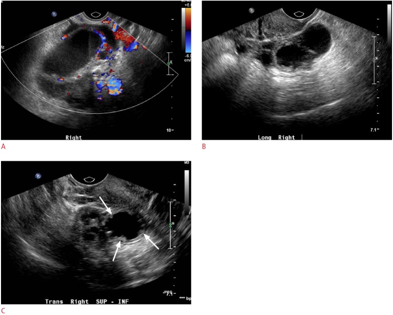 Fig. 11.