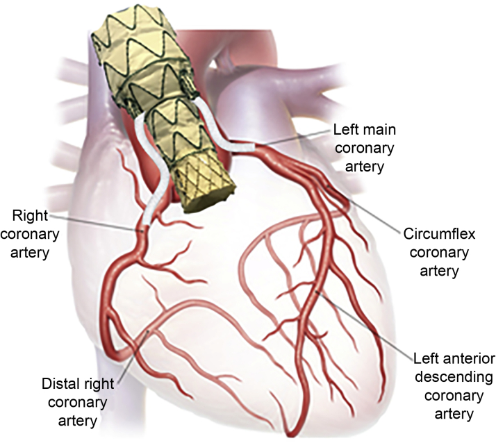 Figure 2