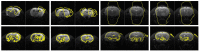 Fig. 11