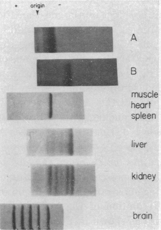 graphic file with name pnas00165-0221-b.jpg