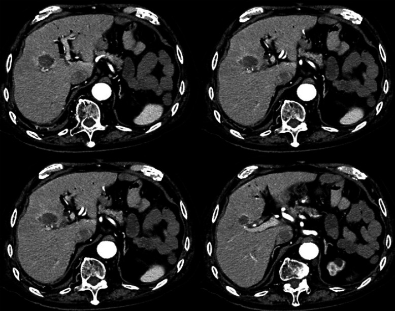 Fig. 3