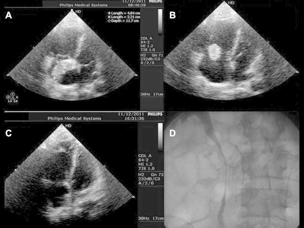 Fig. 1